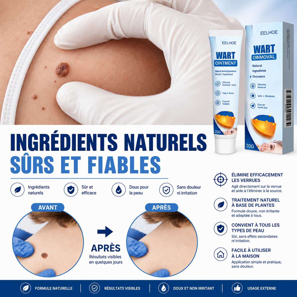 EELHOE WART OINTMENT — Soin ciblé pour une peau plus nette