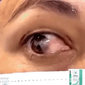 Roller Yeux Anti-Fatigue