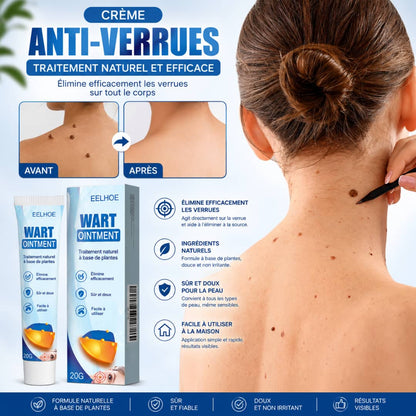EELHOE WART OINTMENT — Soin ciblé pour une peau plus nette